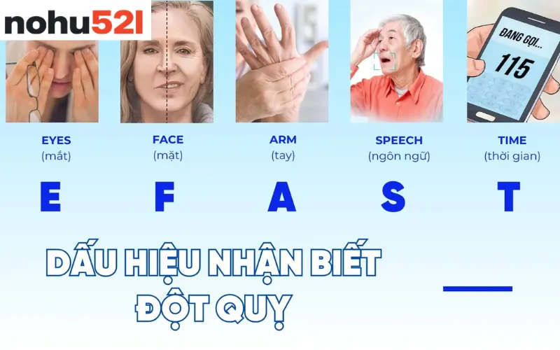 A – Arms (Tay/Chân): Mất sức hoặc liệt một bên cơ thể